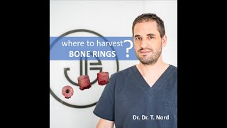 Different kinds of bone rings for the bonering technique [upl. by Hartman]