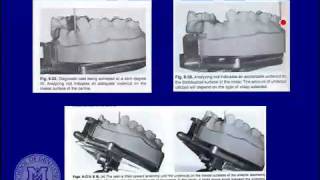 Dental System™ 2012  Removable Partial Design [upl. by Razal]