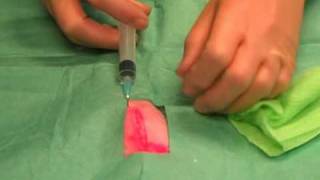 Suturing 1 Infiltrating local anaesthetic [upl. by Oderfodog]