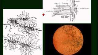 neuroophthalmology pt4 [upl. by Billie]