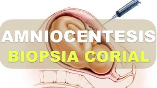 Amniocentesis y Biopsia Corial Explicación [upl. by Neroc]