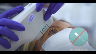 Benefits of Brow Lift Surgery  Plastic Surgeon Explains EyeBrow Lifts [upl. by Einotna]