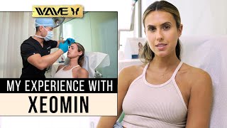 Fashion Bloggers Experience with Xeomin after Years of Botox  Wave Plastic Surgery [upl. by Ahseyn]