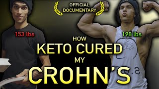 How Keto Cured My Crohns  Official Documentary [upl. by Hook]