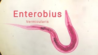 Enterobius vermicularis OXIURO [upl. by Lotty]