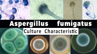 Aspergillus Fumigatus Culture Characteristic [upl. by Yuri]