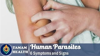 6 Symptoms of Human Parasites Everyone Should Know [upl. by Feeley]