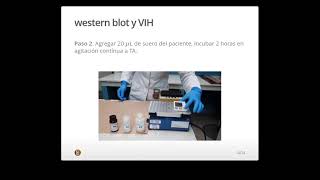 QCB PRÁCTICA WESTERN BLOT PARA DIAGNÓSTICO DE INFECCIÓN POR VIH [upl. by Ellerret]