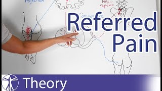 Referred Pain Explained [upl. by Compte]