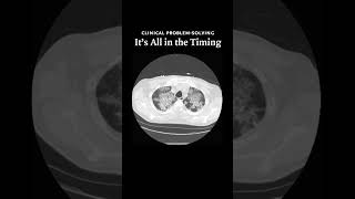 It’s All in the Timing Video 2  NEJM [upl. by Oliy194]