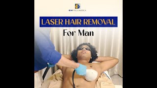 Laser Hair Removal For Men Patient Review [upl. by Ydarg850]