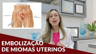 Embolização de miomas uterinos  Dra Nayara Cioffi Batagini  Cirurgia Vascular e Endovascular [upl. by Ayotahs]