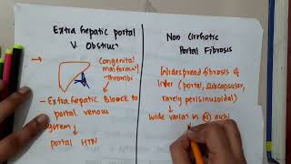 non cirrhotic portal hypertension  Hepatobiliary System [upl. by Thom]