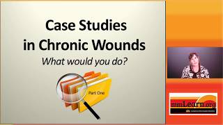 Case Studies in Chronic Wounds  Part 1 [upl. by Sucramd]