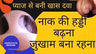 10 बूँद से फेफड़े को रखें हमेशा जवान  Allium cepa 30 200 homeopathic medicine uses dosage [upl. by Eberto]