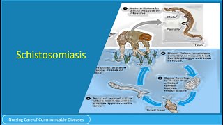 Schistosomiasis [upl. by Enialed]