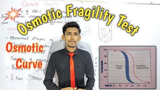 Osmotic Fragility Test  Osmotic Curve  Hemolytic Test [upl. by Mercier422]