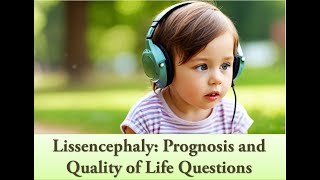 4 Lissencephaly Prognosis and Quality of Life Questions [upl. by Llenyar]