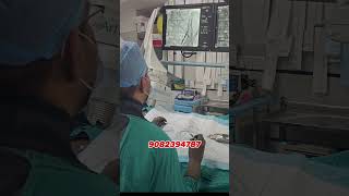 Embolization technique se testis ka Dard kiya durnosurgery minimallyinvasive [upl. by Kenna]