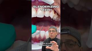 How Invisalign Can Fix Minimal Crowding of Teeth  View Mobile Dental shorts [upl. by Geesey737]