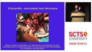 Paravalvular leak transoesophageal echocardiography [upl. by Anaeel]