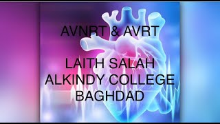 AVNRT amp AVRT  ARRHYTHMIA [upl. by Nomyad261]