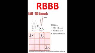 RBBBRight bundle branch blockECG interpretation ecg [upl. by Ardyce224]