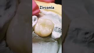 shorts Zirconia Dental [upl. by Kincaid]