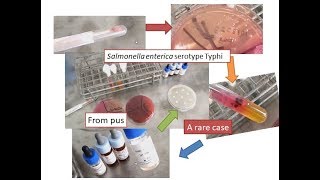 Salmonella from wound swab a rare case report [upl. by Devland]