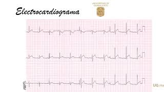 Pericarditis Aguda [upl. by Sadye272]