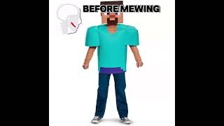 Before and after mewingedit mewing ￼ [upl. by Leggat900]