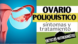 SÍNDROME DE OVARIO POLIQUÍSTICO o SOP  Síntomas y tratamiento [upl. by Ed]