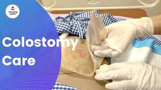 COLOSTOMY CARE [upl. by Ahtram404]