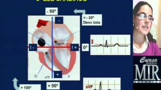 Cómo interpretar un ECG repaso [upl. by Ilah741]