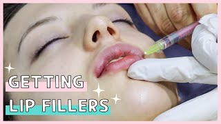 Getting Lip Fillers and Lip Corner Lift In Korea  How Its Like  Before amp After  Eunogo Beauty [upl. by Lenor804]