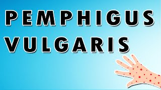 Pemphigus Vulgaris Symptoms Treatment and Causes [upl. by Octavie]