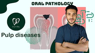 Pulp diseases  oral pathology [upl. by Perpetua]