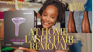 AT HOME LASER HAIR REMOVAL FOR MELANATED SKIN DERMRAYS V6S REVIEW [upl. by Aicilihp]