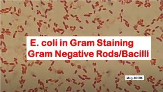 E coli in Gram Staining [upl. by Lawley]