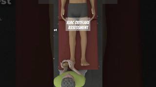 Iliac Outflare Assessment [upl. by Ybrek]