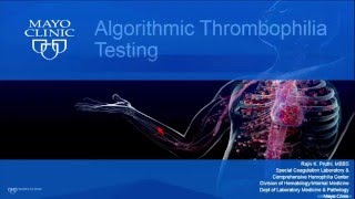 Algorithmic Thrombophilia Testing [upl. by Mutua]