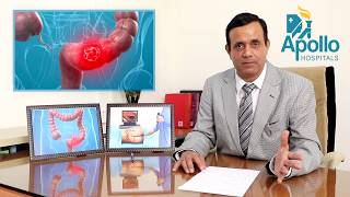 Colonoscopy Sigmoidoscopy in Hindi Dr Shravan Bohra liver specialistApolloAhmedabad [upl. by Nath]