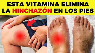 ESTA es LA MEJOR VITAMINA para ELIMINAR la HINCHAZÓN en PIES y PIERNAS [upl. by Yatnuahc]