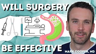 Can you Have SURGERY for GERD AntiReflux Surgery [upl. by Aiekan]