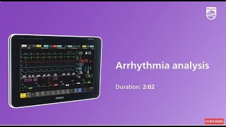 Arrhythmia analysis IVPM N [upl. by Perkins]