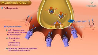 Myasthenia Gravis Etiology  Pathogenesis Classification  Clinical features Diagnosis Treatment [upl. by Dene]