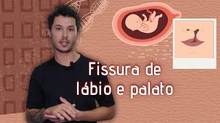 Ambiente embrionário influencia o DNA na fissura labiopalatina  Epigenética 7 [upl. by Lalat974]