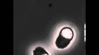 Crawling C elegans sperm [upl. by Aerb]