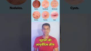 मुहांसों की हर्बल क्रीम।।acne removal creamacne killeraqui plus cream [upl. by Anivram694]