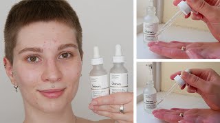 How to use The Ordinary Hyaluronic Acid and Niacinamide [upl. by Vere]